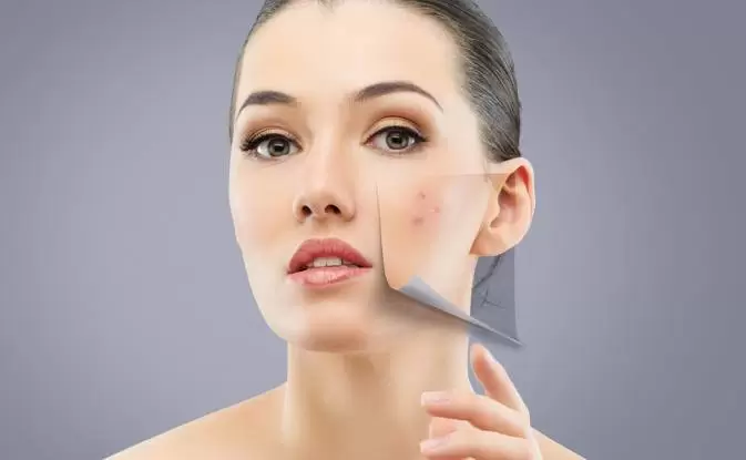 acne scar treatment malaysia